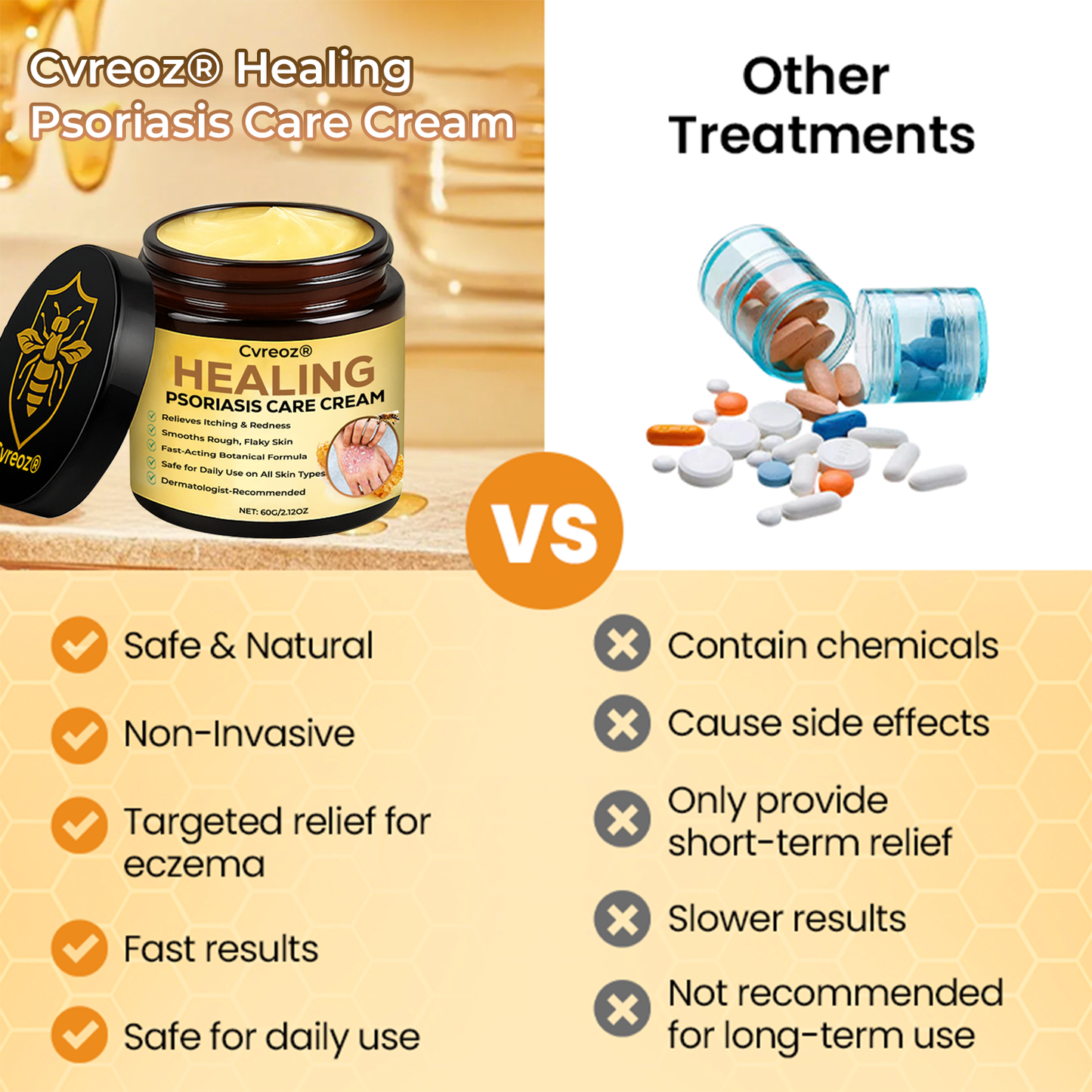 ⏰Last Day Promotion: 65% OFF🔥 Cvreoz® Healing Psoriasis Care Cream
