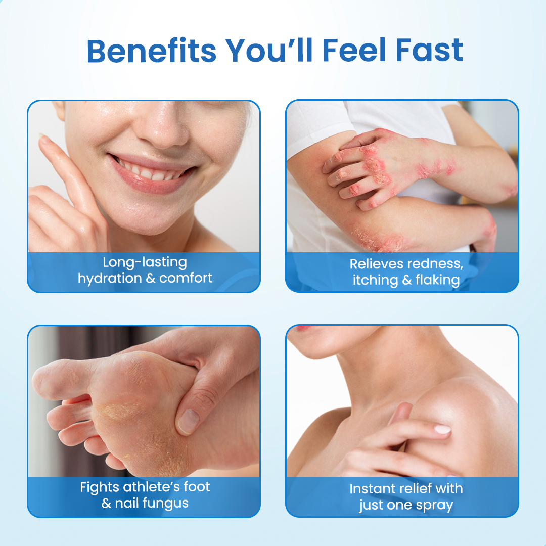 Cvreoz® MagnesiumHerb Psoriasis Relief Cream