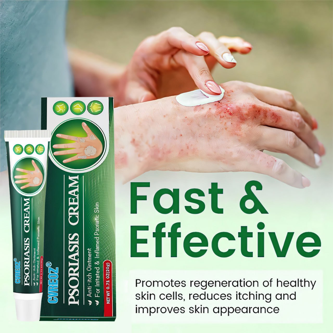 Cvreoz® Knotaway Psoriasis Cream🔥LIMITED SALE: 60% OFF🔥