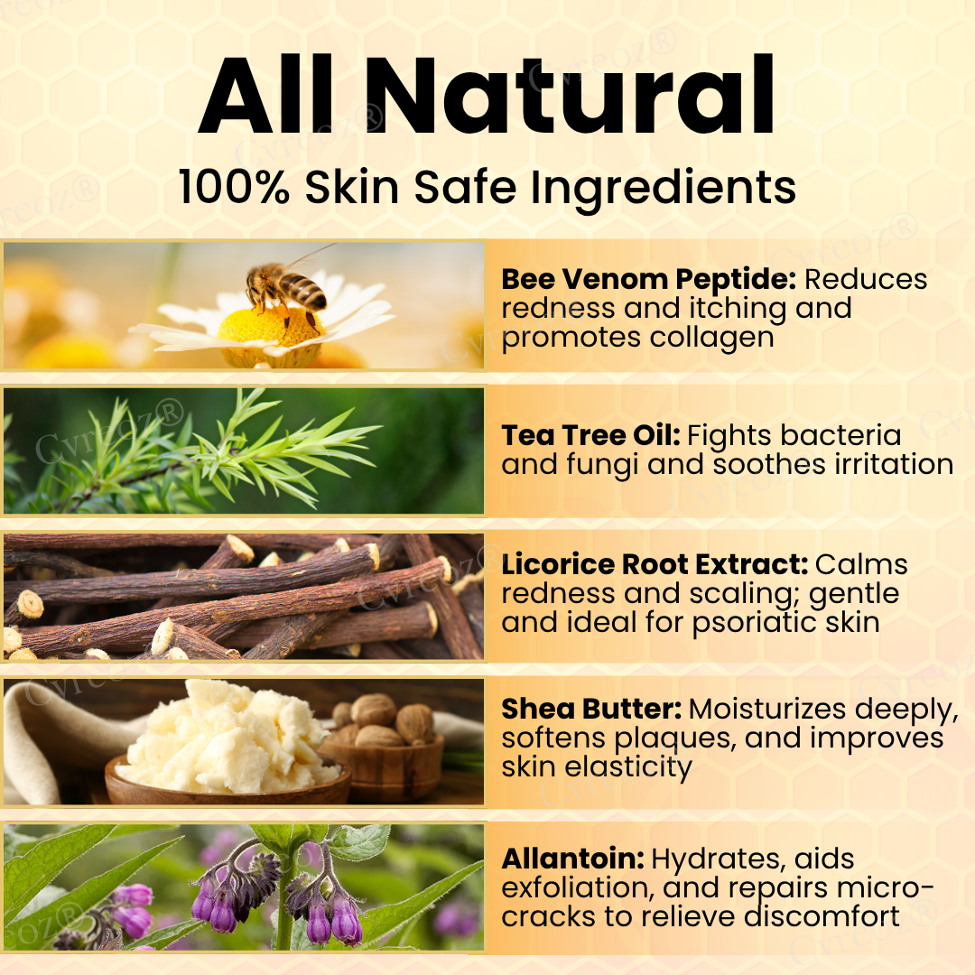 đ LIMITED OFFER 60% OFF đ CvreozÂź Bee Venom Psoriasis Cream