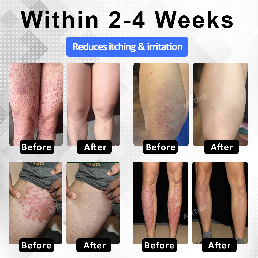 ⏰LIMITED TIME SALE OFF 60%🔥 Cvreoz® MagniCalm Magnesium Healing Foam