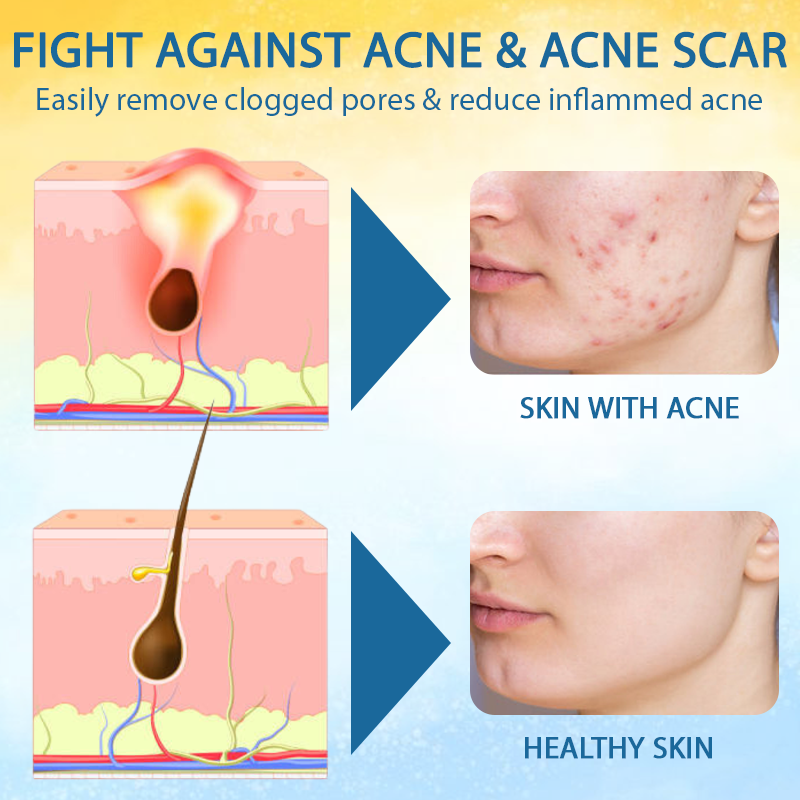 Cvreoz® PsoriasisCare Mellifera Venom Skin Healing Spray🔥