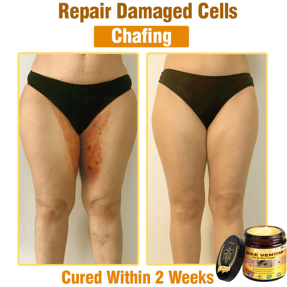 ⏰Last Day Promotion: 60% OFF🔥Cvreoz® Bee Venom All-in-One Cream