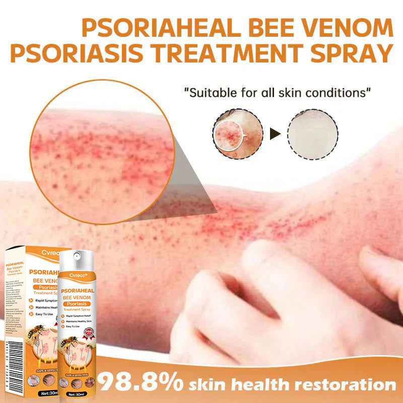 ⏰Last Day Promotion: 60% OFF🔥 Cvreoz® PsoriaHeal Bee Venom Psoriasis Treatment Spray