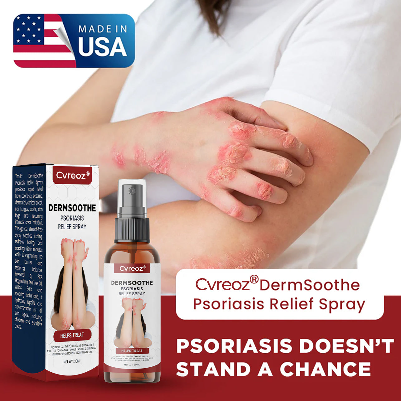 Cvreoz® DermSoothe Psoriasis Relief Spray —Clinically Tested, FDA-Recognized Formula