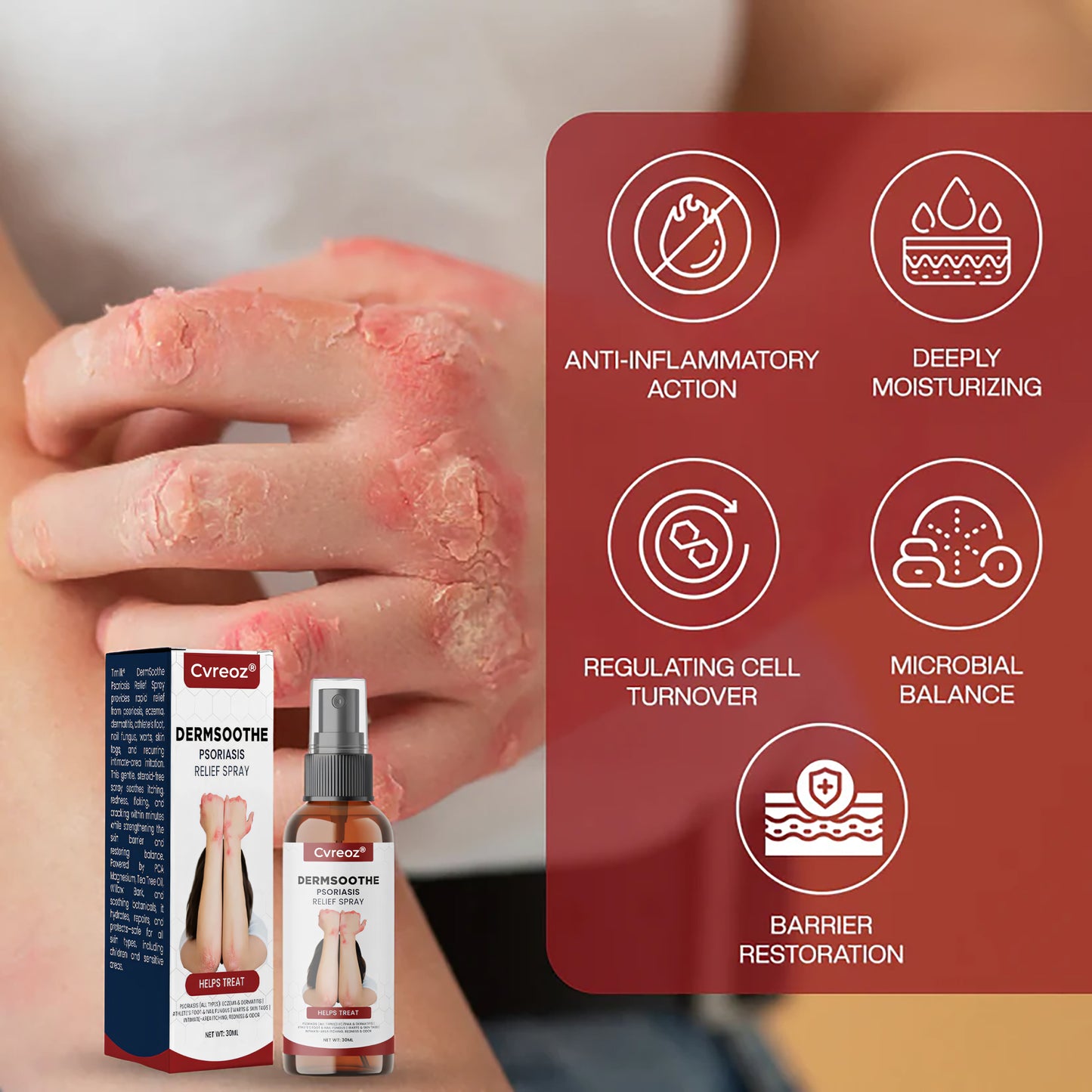 Cvreoz® DermSoothe Psoriasis Relief Spray —Clinically Tested, FDA-Recognized Formula