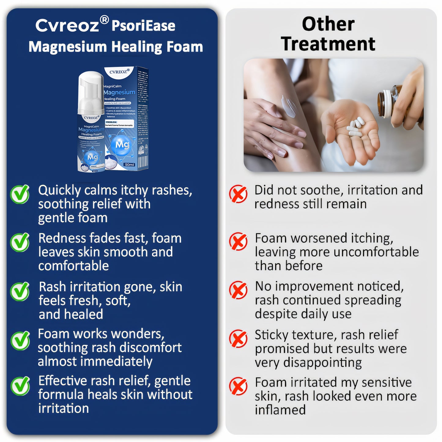 ⏰LIMITED TIME SALE OFF 60%🔥 Cvreoz® MagniCalm Magnesium Healing Foam