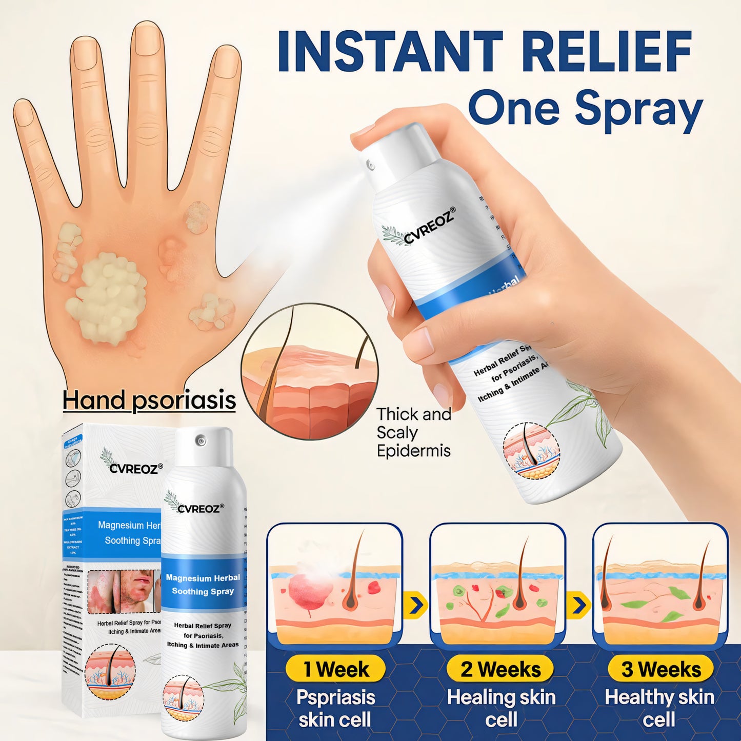 Cvreoz® Magnesium Herbal Psoriasis Spray 👨⚕️ FDA Approved