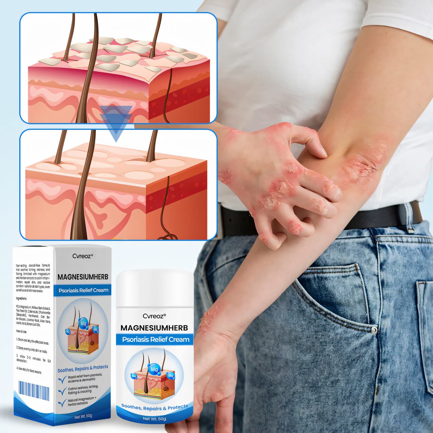 Cvreoz® MagnesiumHerb Psoriasis Relief Cream