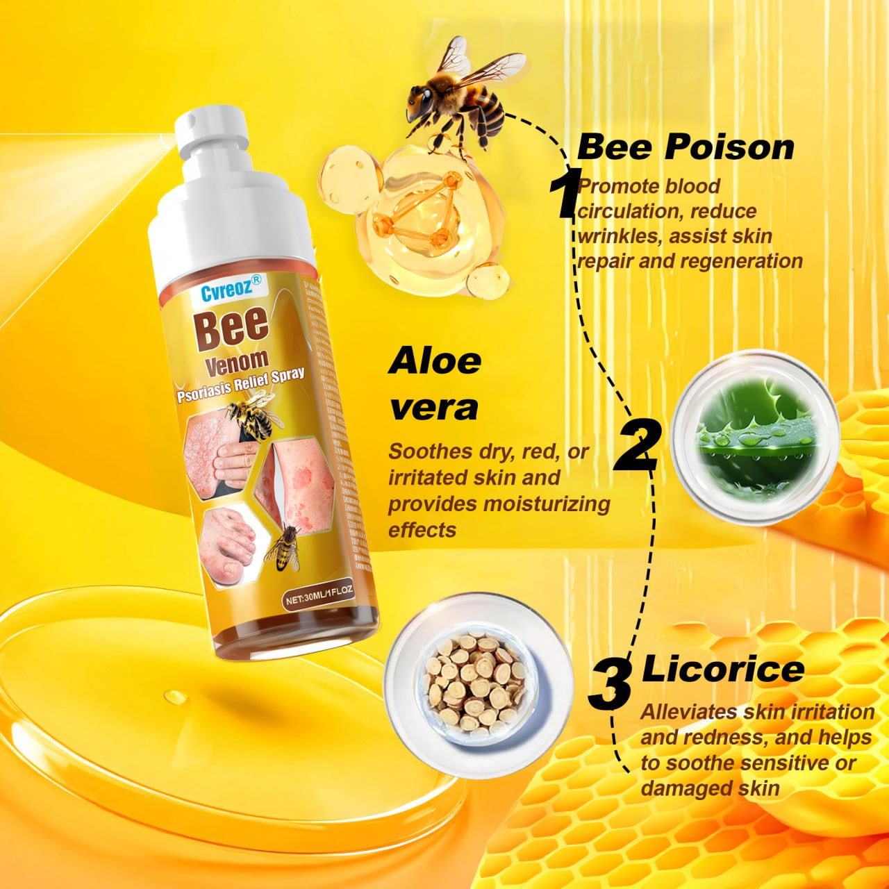 🐝 LIMITED OFFER 60% OFF 💛 Cvreoz® Bee Venom Psoriasis Relief Spray