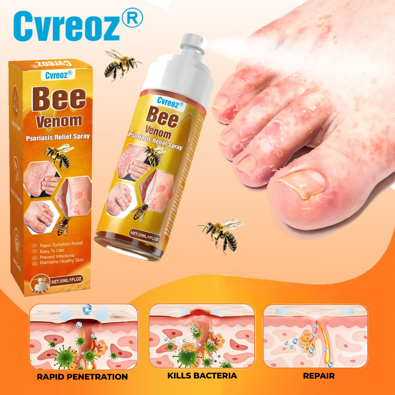 🐝 LIMITED OFFER 60% OFF 💛 Cvreoz® Bee Venom Psoriasis Relief Spray