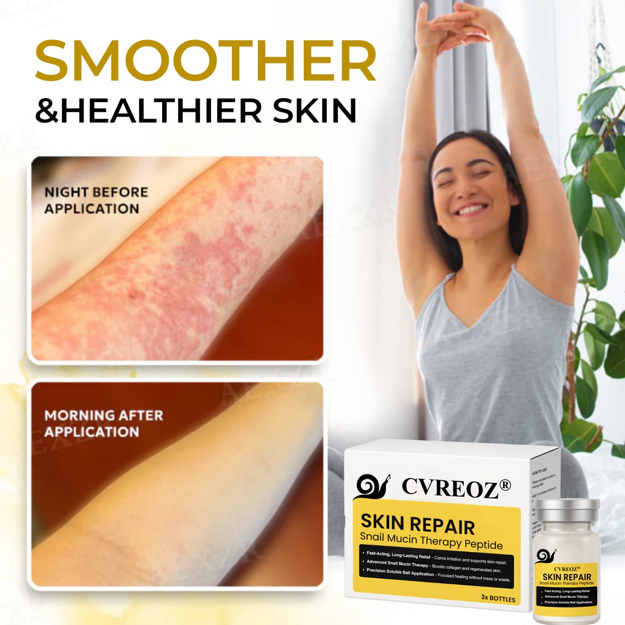 đ„Last Day Promotion: 60% OFFđ„ CvreozÂź Snail Peptide Psoriasis Serum