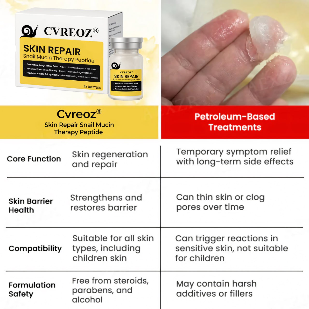 đ„Last Day Promotion: 60% OFFđ„ CvreozÂź Snail Peptide Psoriasis Serum