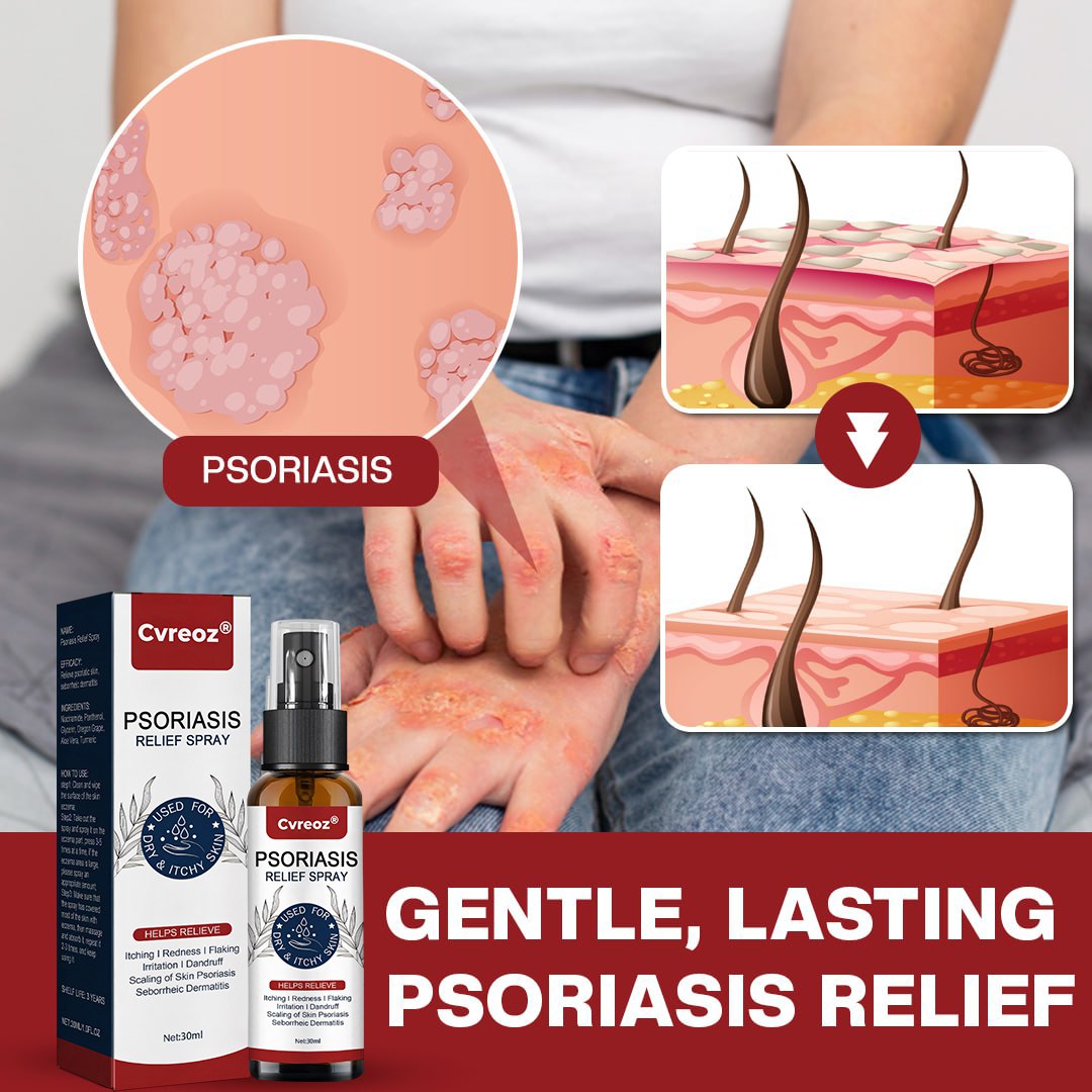 đ LIMITED OFFER: 60% OFF ONLY FOR TODAY đ CvreozÂź DermSoothe Psoriasis Relief Spray