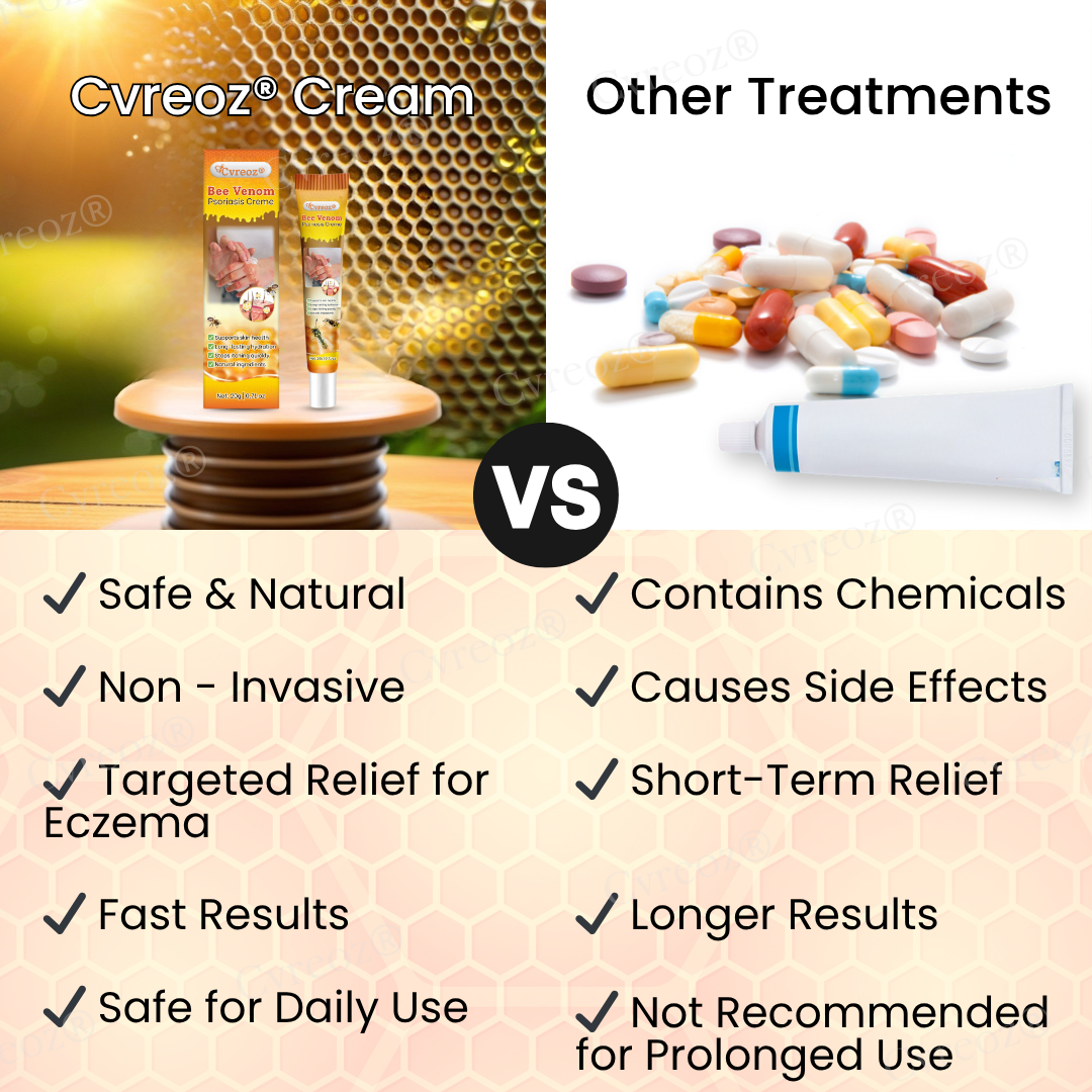 🐝 LIMITED OFFER 60% OFF 💛 Cvreoz® Bee Venom Psoriasis Cream