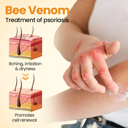 ⏰Last Day Promotion: 60% OFF🔥 Cvreoz® BeeLief Psoriasis Skin Care Cream