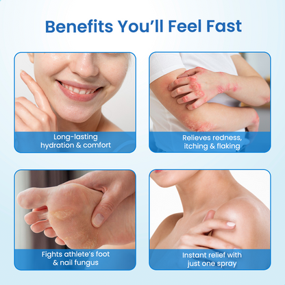 Cvreoz® MagnesiumHerb Psoriasis Relief Cream