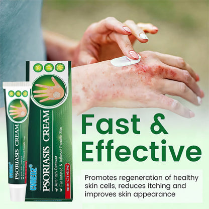 Cvreoz® Knotaway Psoriasis Cream🔥LIMITED SALE: 60% OFF🔥