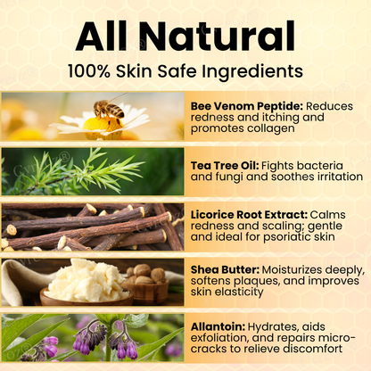 🐝 LIMITED OFFER 60% OFF 💛 Cvreoz® Bee Venom Psoriasis Cream