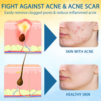 Cvreoz® PsoriasisCare Mellifera Venom Skin Healing Spray🔥