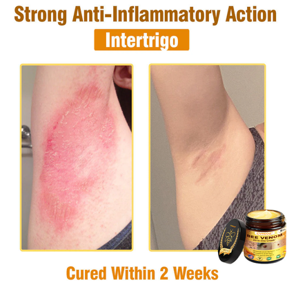⏰Last Day Promotion: 60% OFF🔥Cvreoz® Bee Venom All-in-One Cream