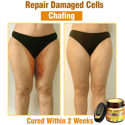⏰Last Day Promotion: 60% OFF🔥Cvreoz® Bee Venom All-in-One Cream