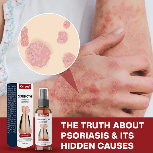 Cvreoz® DermSoothe Psoriasis Relief Spray —Clinically Tested, FDA-Recognized Formula