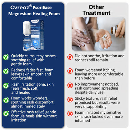 ⏰LIMITED TIME SALE OFF 60%🔥 Cvreoz® MagniCalm Magnesium Healing Foam
