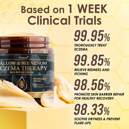 ⚡Final Chance: Save 60% Today Only🔥Cvreoz® Tallow & Bee Venom Eczema Theraphy