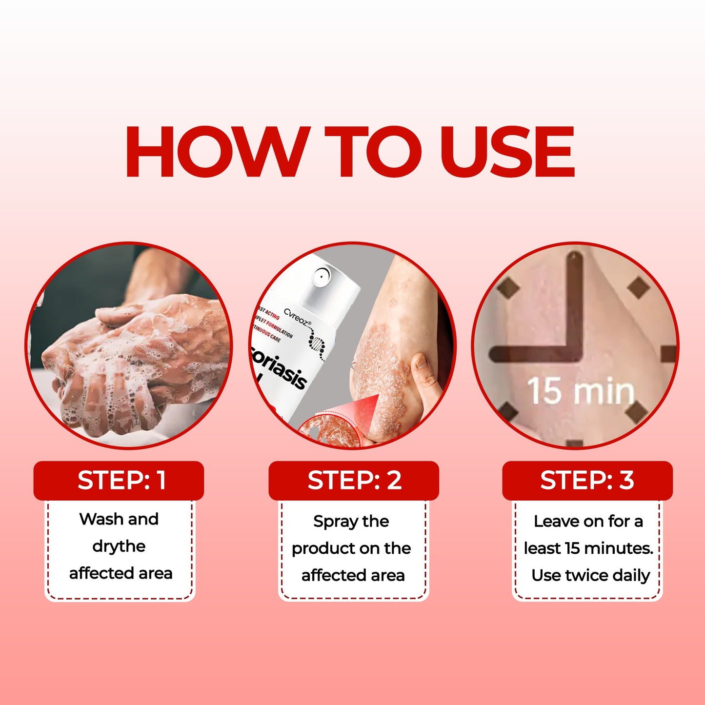 🎉HOT SALE: 60% OFF This Week Only!🔥 Cvreoz®  Psoriasis Heal Bee Venom Treatment Spray