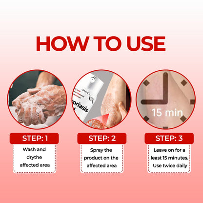 🎉HOT SALE: 60% OFF This Week Only!🔥 Cvreoz®  Psoriasis Heal Bee Venom Treatment Spray