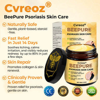 🔥 60% OFF – Cvreoz® Beepure psoriasis Skin Care