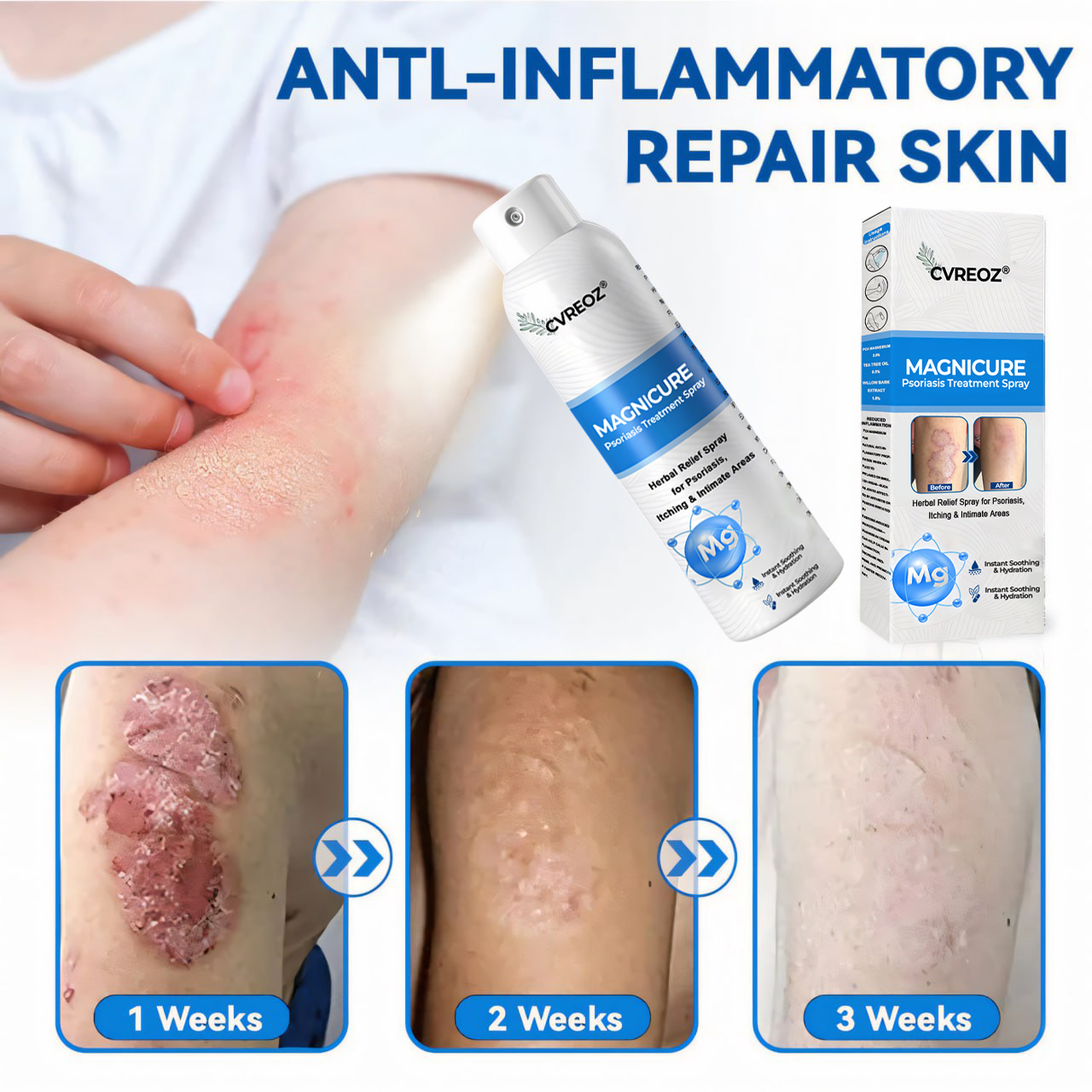 🎉SPECIAL LAUNCH OFFER: 60% OFF This Week Only!🔥 Cvreoz® MagniCure Psoriasis Treatment Spray