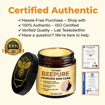 🔥 60% OFF – Cvreoz® Beepure psoriasis Skin Care