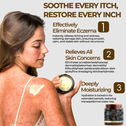 ⚡Final Chance: Save 60% Today Only🔥Cvreoz® Tallow & Bee Venom Eczema Theraphy