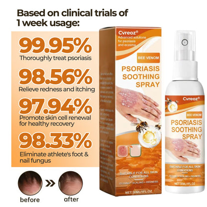 🔥Cvreoz® Bee Venom Psoriasis Soothing Spray 🐝 LIMITED OFFER: 60% OFF 🔥