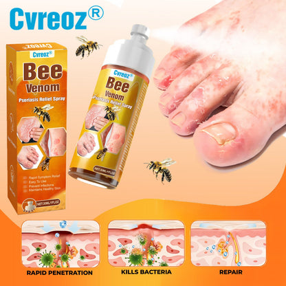 🐝 LIMITED OFFER 60% OFF 💛 Cvreoz® Bee Venom Psoriasis Relief Spray