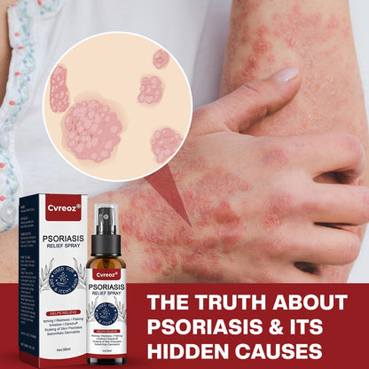 💛 LIMITED OFFER: 60% OFF ONLY FOR TODAY 💛 Cvreoz® DermSoothe Psoriasis Relief Spray